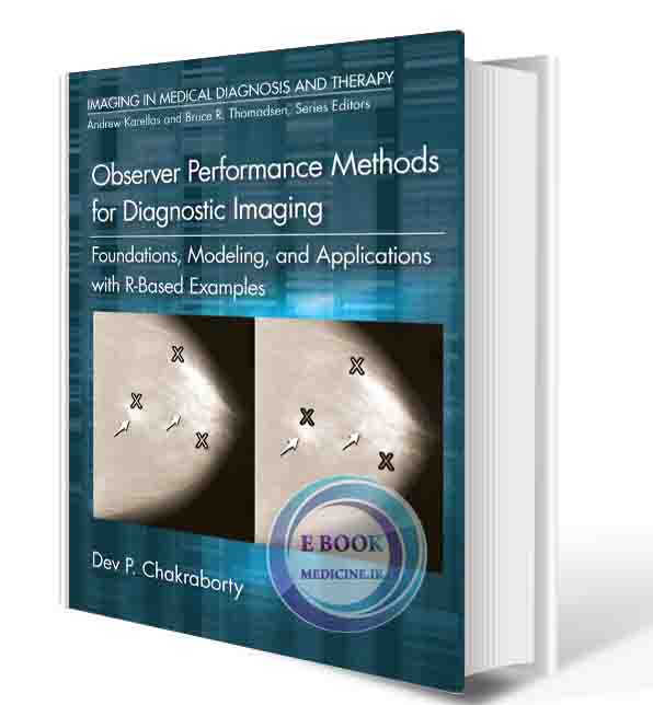 دانلود کتابObserver Performance Methods for Diagnostic Imaging: Foundations, Modeling, and Applications with R-Based Examples (Imaging in Medical Diagnosis and Therapy) 2017 (ORIGINAL PDF)